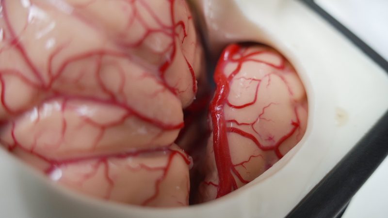 Meningioma: A Comprehensive Clinical Guide for Patients