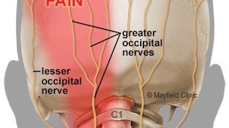 Pain as a Diagnostic Gateway: When Your Headache Is More Than Stress
